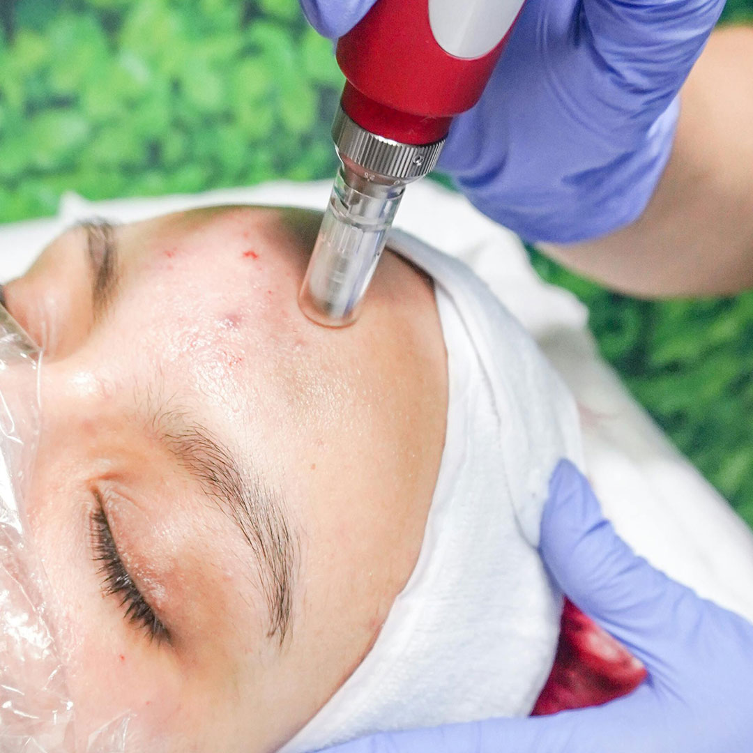 Diamond Glow Facial